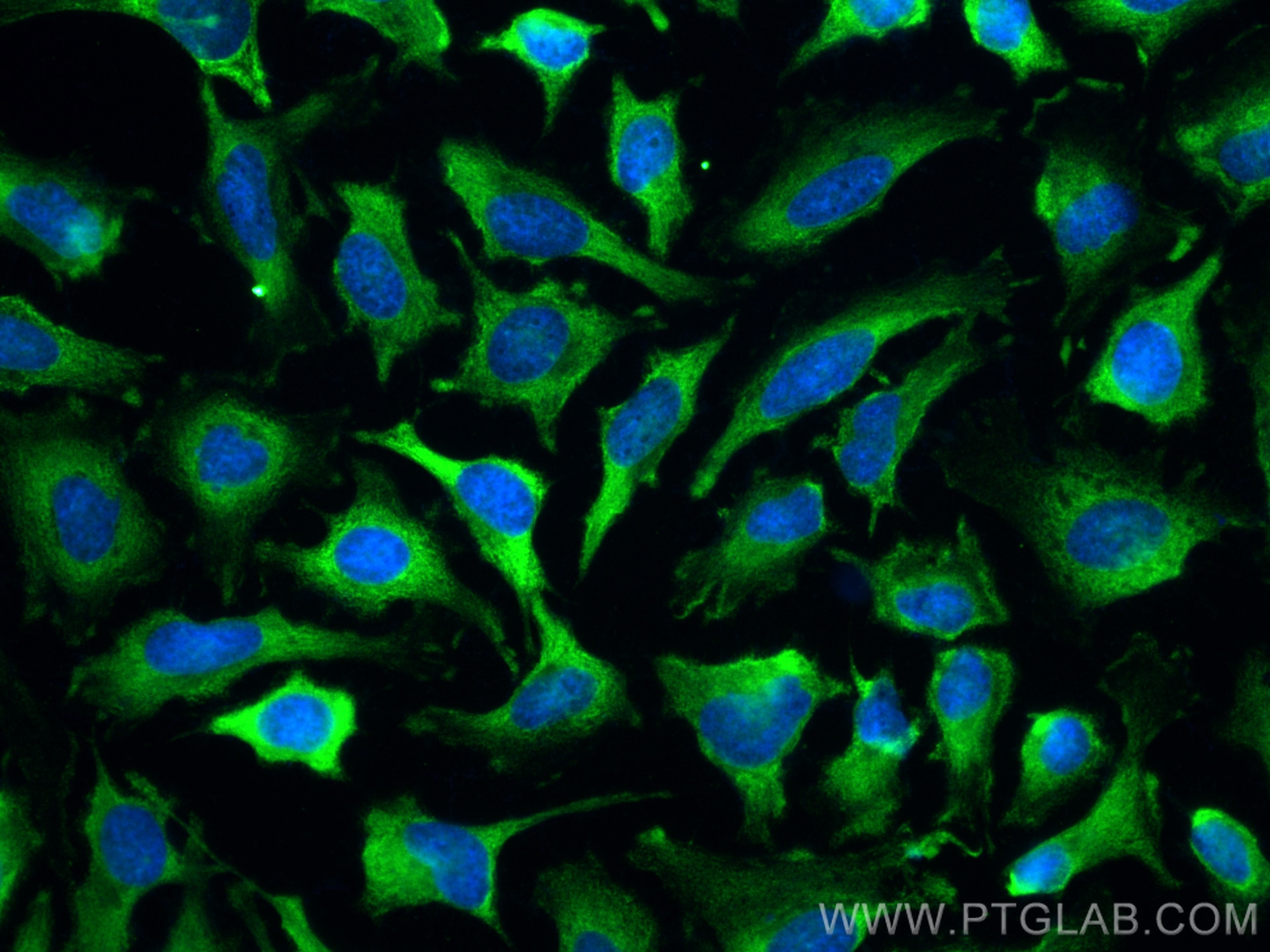 Immunofluorescence (IF) / fluorescent staining of HeLa cells using CoraLite® Plus 488-conjugated ValRS Monoclonal ant (CL488-67935)
