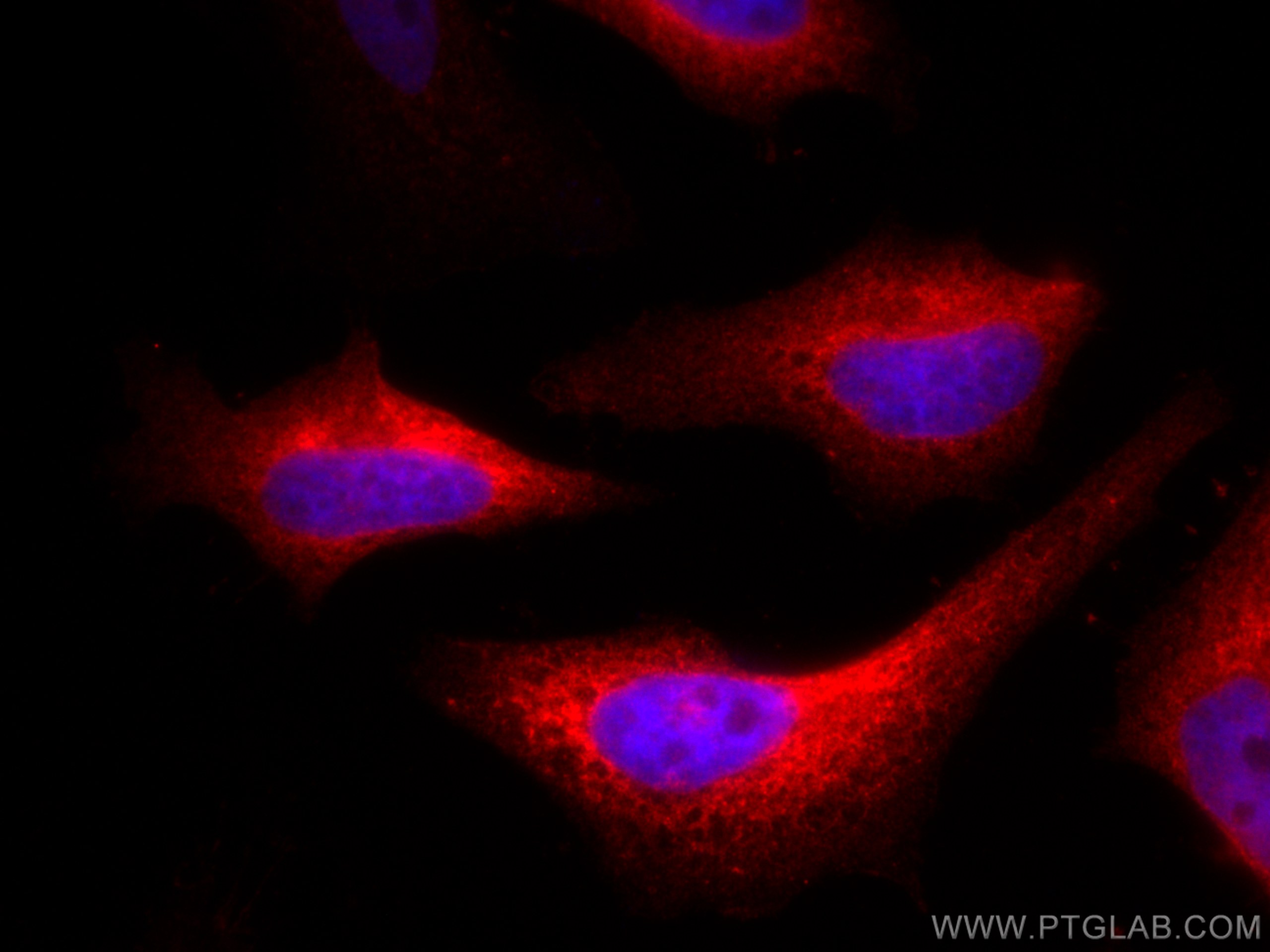 Immunofluorescence (IF) / fluorescent staining of HeLa cells using CoraLite®594-conjugated ValRS Monoclonal antibody (CL594-67935)