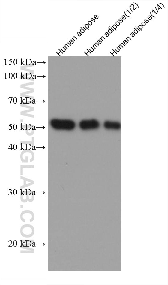 Western Blot (WB) analysis of various lysates using Vaspin Monoclonal antibody (67573-1-Ig)