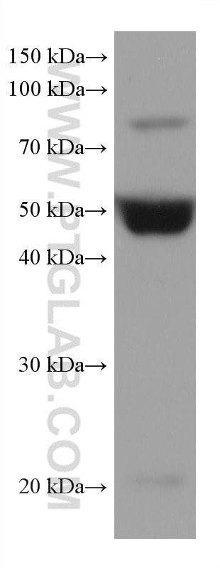 Western Blot (WB) analysis of human placenta tissue using Vaspin Monoclonal antibody (67573-1-Ig)