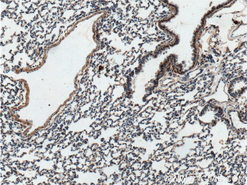 IHC staining of mouse lung using 26157-1-AP