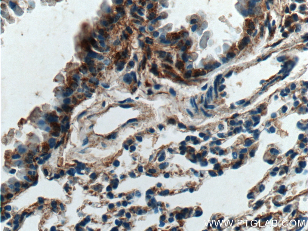 Immunohistochemistry (IHC) staining of mouse lung tissue using Vegfa Polyclonal antibody (26157-1-AP)