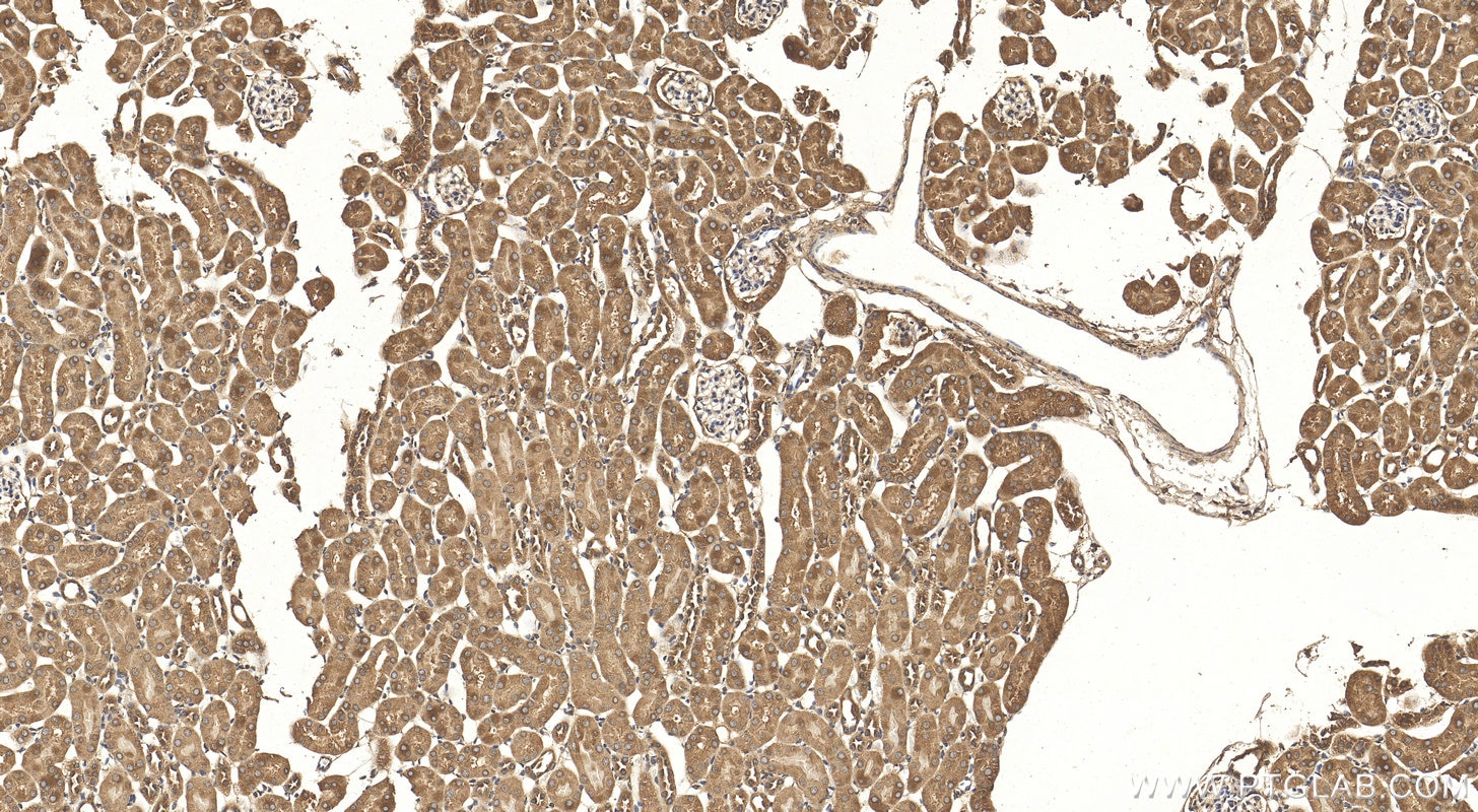 Immunohistochemistry (IHC) staining of mouse kidney tissue using VEGFA Polyclonal antibody (26157-1-AP)