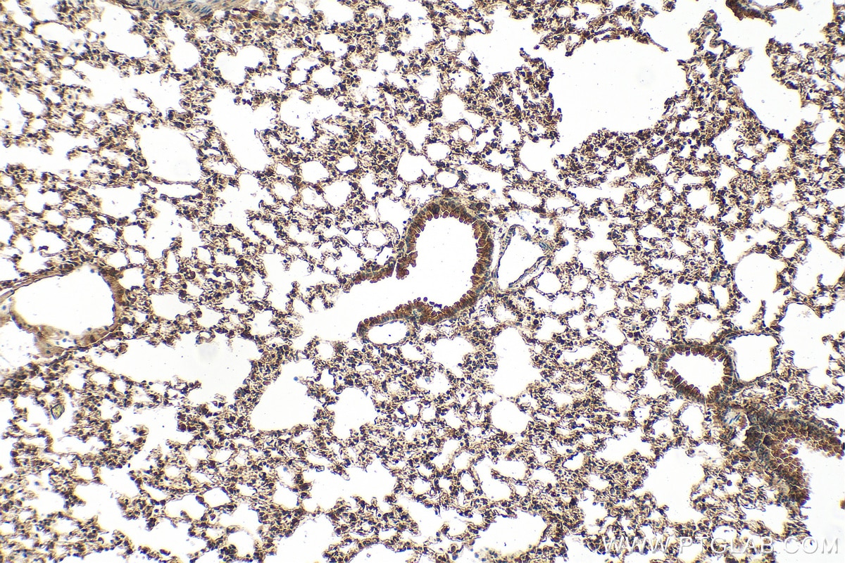 Immunohistochemistry (IHC) staining of mouse lung tissue using VEGFA Polyclonal antibody (26157-1-AP)