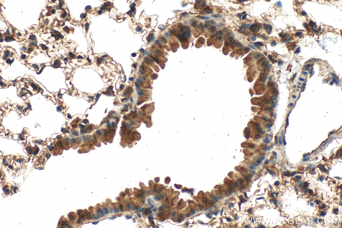 Immunohistochemistry (IHC) staining of mouse lung tissue using VEGFA Polyclonal antibody (26157-1-AP)