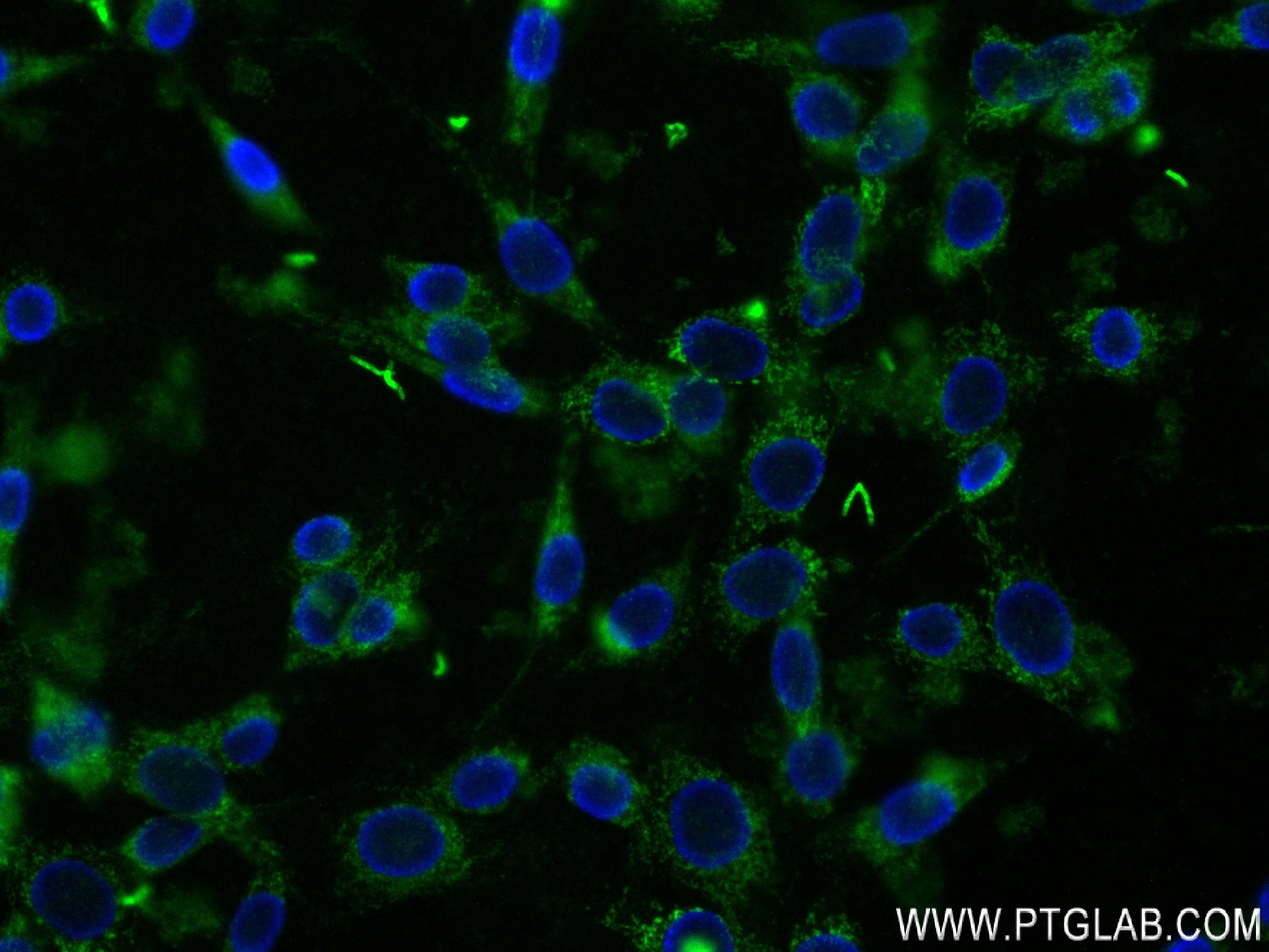 Immunofluorescence (IF) / fluorescent staining of NIH/3T3 cells using VEGFA Recombinant antibody (82864-7-RR)