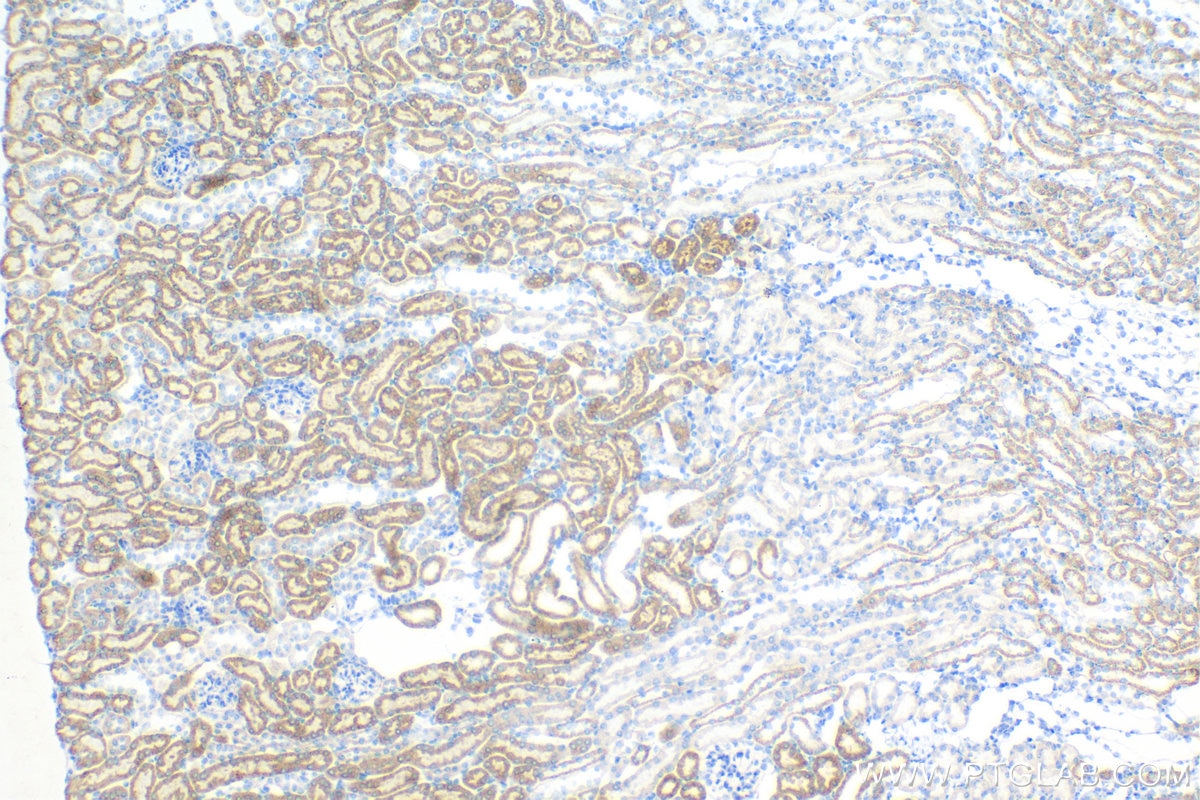 Immunohistochemistry (IHC) staining of mouse kidney tissue using VEGFA Recombinant antibody (82864-7-RR)