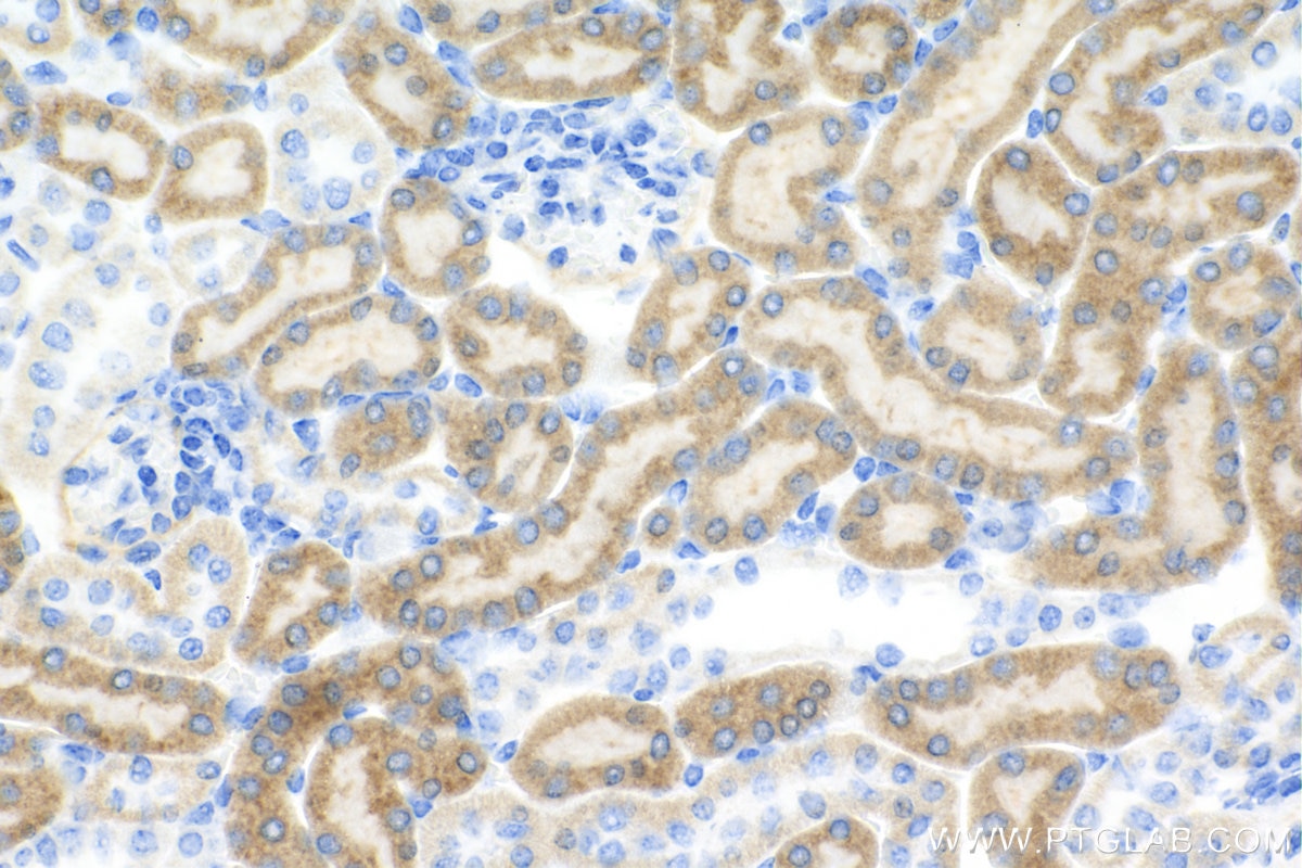Immunohistochemistry (IHC) staining of mouse kidney tissue using VEGFA Recombinant antibody (82864-7-RR)