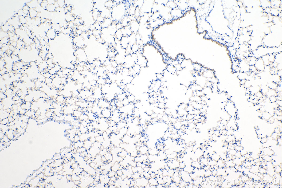 Immunohistochemistry (IHC) staining of mouse lung tissue using VEGFA Recombinant antibody (82864-7-RR)