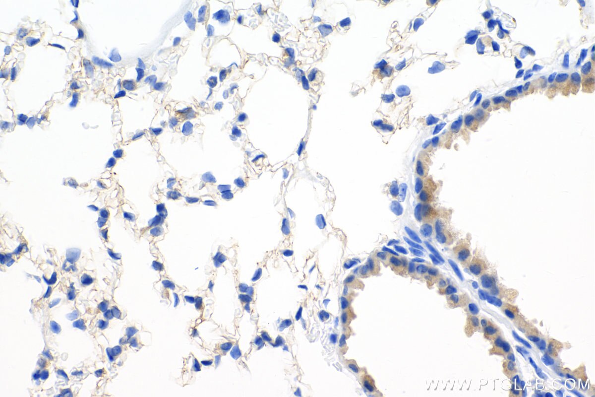 Immunohistochemistry (IHC) staining of mouse lung tissue using VEGFA Recombinant antibody (82864-7-RR)