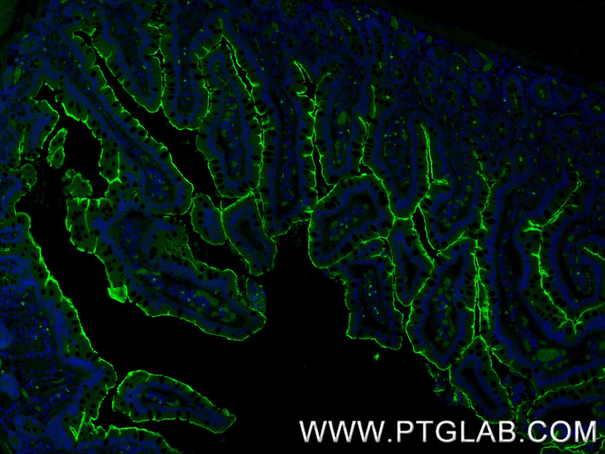 IF Staining of human small intestine using 86978-2-RR Immunofluorescence (IF) / fluorescent staining of human small intestine tissue using Villin Recombinant monoclonal antibody (86978-2-RR)