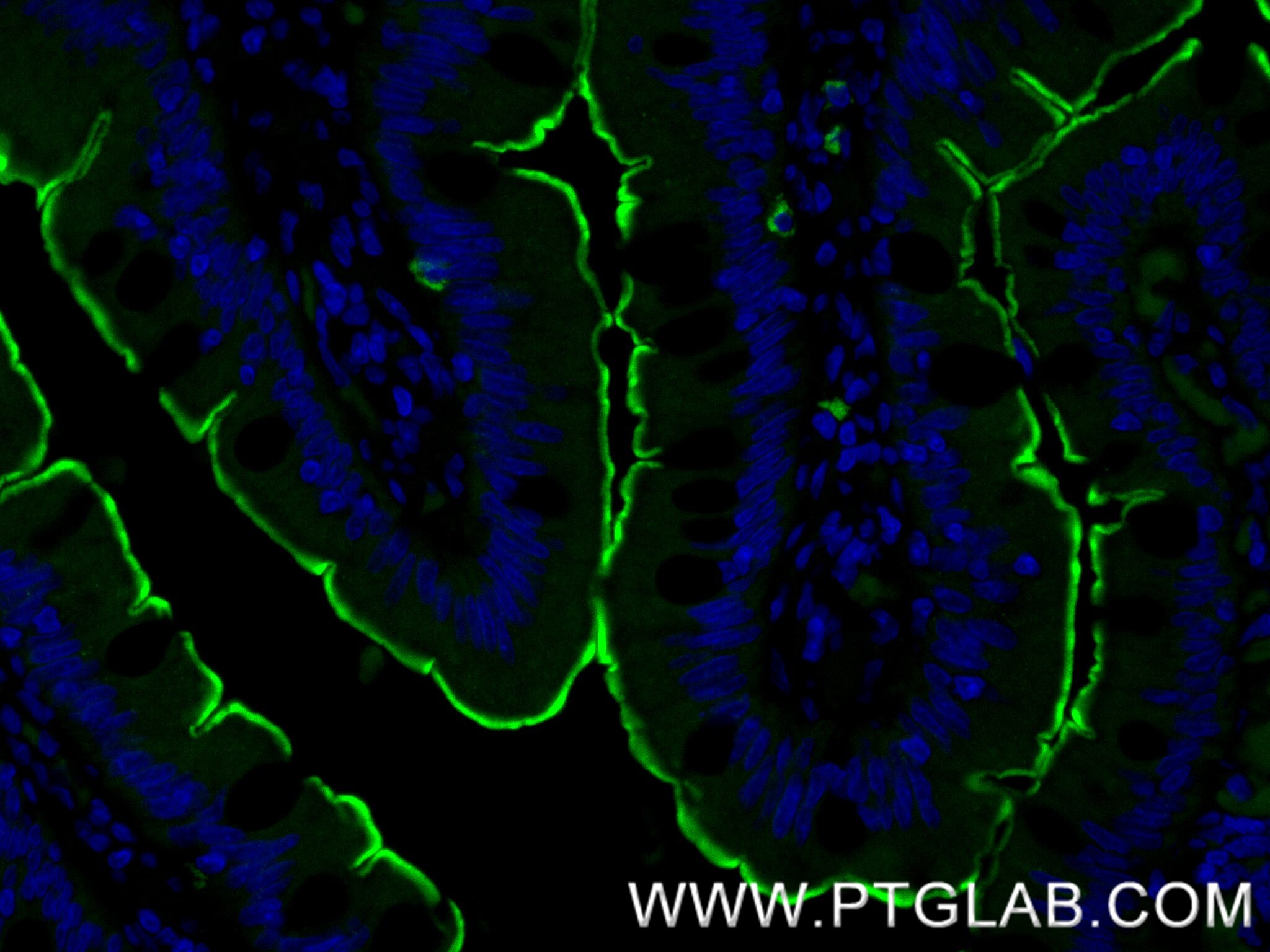 IF Staining of human small intestine using 86978-2-RR Immunofluorescence (IF) / fluorescent staining of human small intestine tissue using Villin Recombinant monoclonal antibody (86978-2-RR)