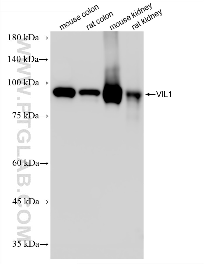 WB analysis using 86978-3-RR Western Blot (WB) analysis of various lysates using Villin Recombinant monoclonal antibody (86978-3-RR)