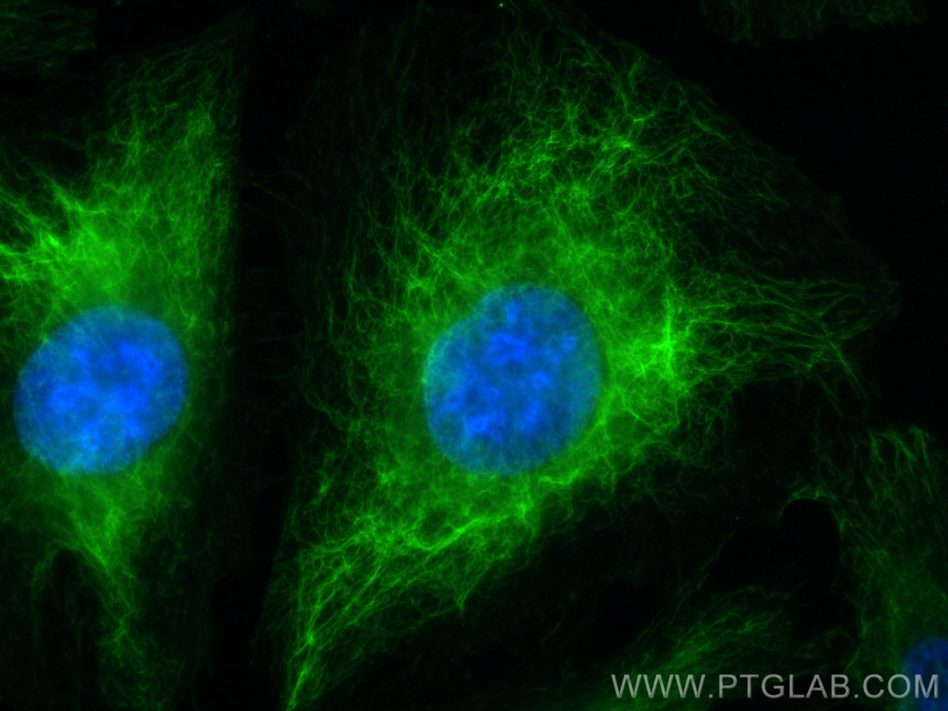 Immunofluorescence (IF) / fluorescent staining of HUVEC cells using Vimentin Monoclonal antibody (60330-1-Ig)