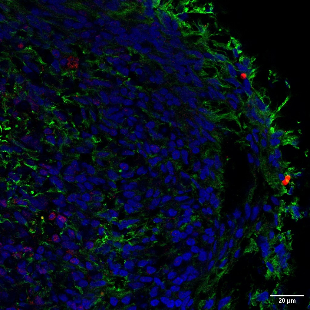 Immunofluorescence (IF) / fluorescent staining of Retinal organoids using Vimentin Monoclonal antibody (60330-1-Ig)