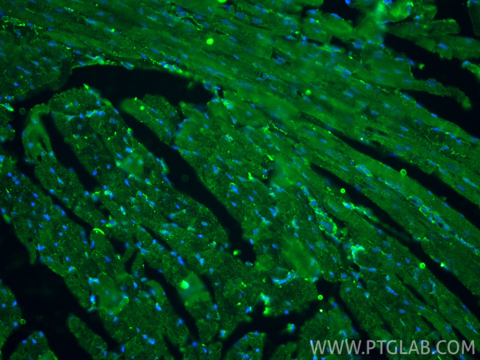 Immunofluorescence (IF) / fluorescent staining of Customer Sample customer using Vimentin Monoclonal antibody (60330-1-Ig)