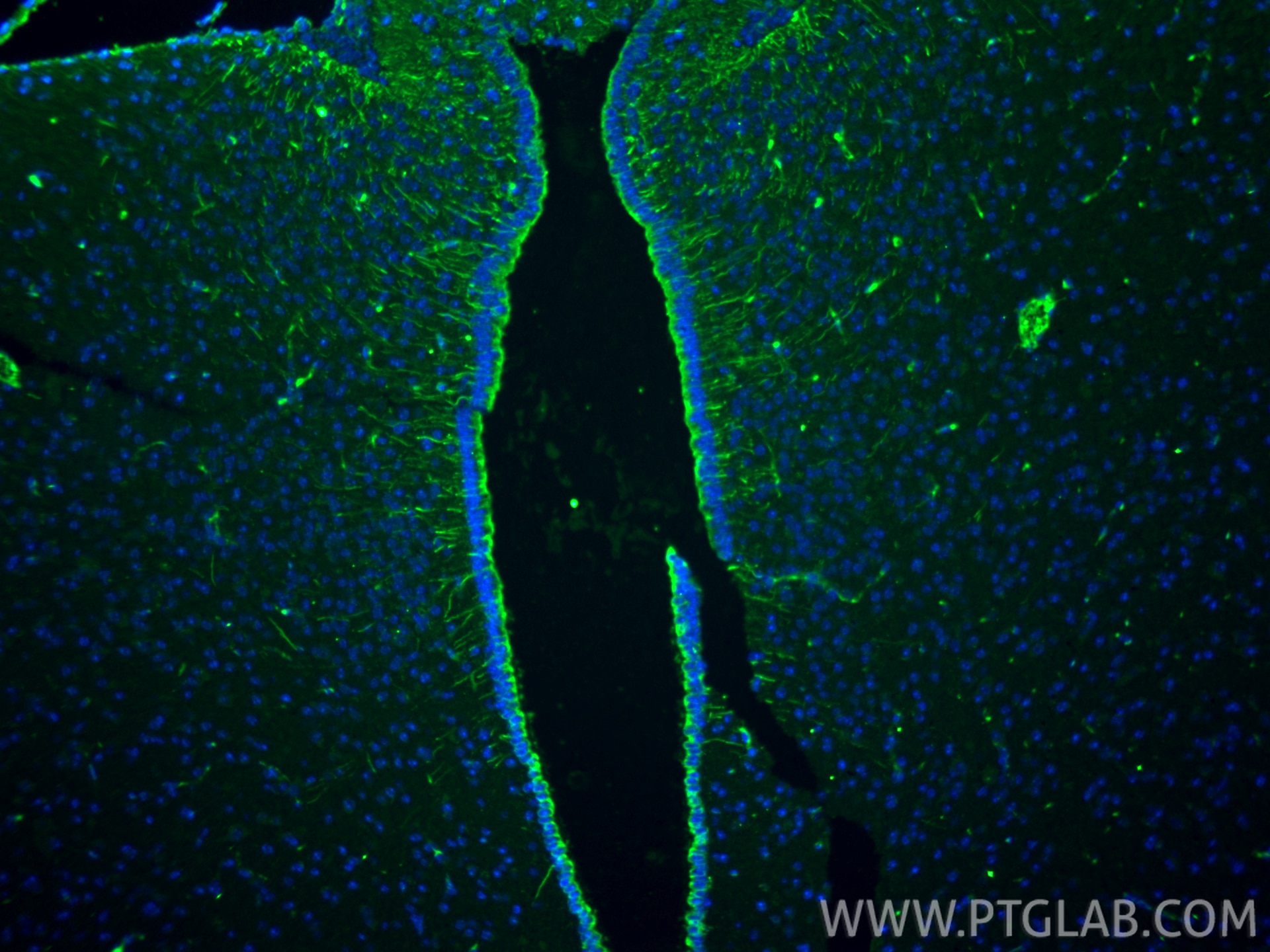 Immunofluorescence (IF) / fluorescent staining of mouse brain tissue using Vimentin Monoclonal antibody (60330-1-Ig)