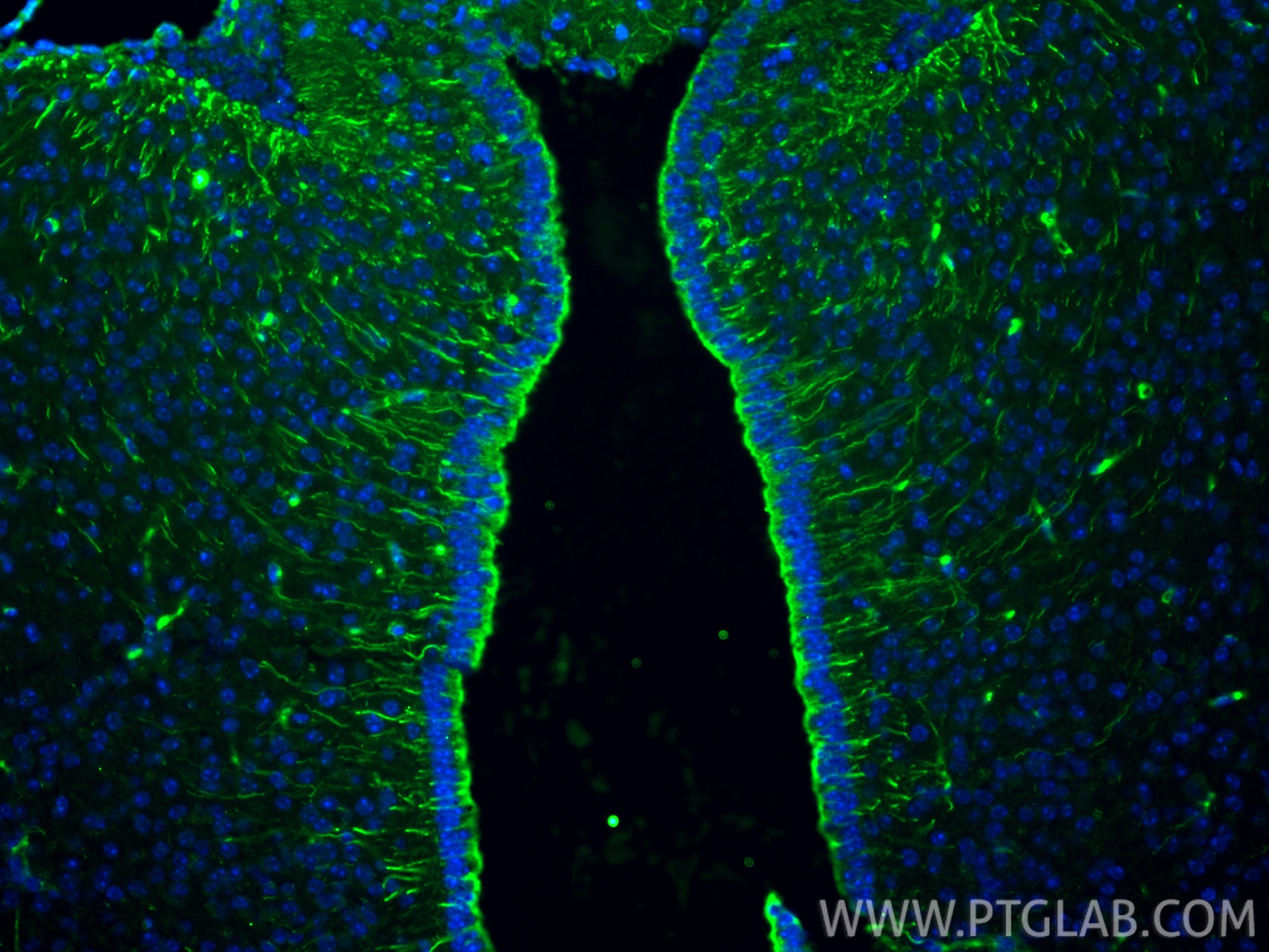 Immunofluorescence (IF) / fluorescent staining of mouse brain tissue using Vimentin Monoclonal antibody (60330-1-Ig)