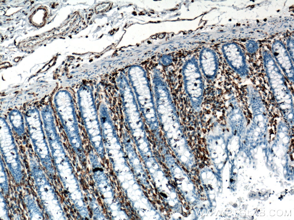 Immunohistochemistry (IHC) staining of human colon tissue using Vimentin Monoclonal antibody (60330-1-Ig)