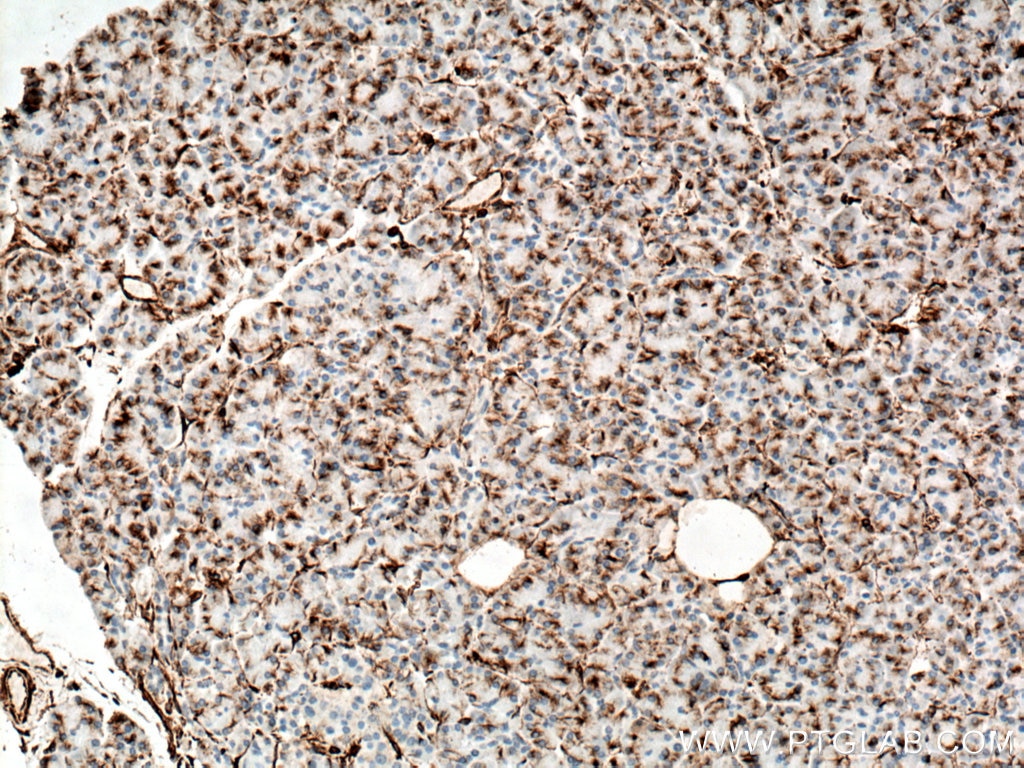 Immunohistochemistry (IHC) staining of human pancreas tissue using Vimentin Monoclonal antibody (60330-1-Ig)