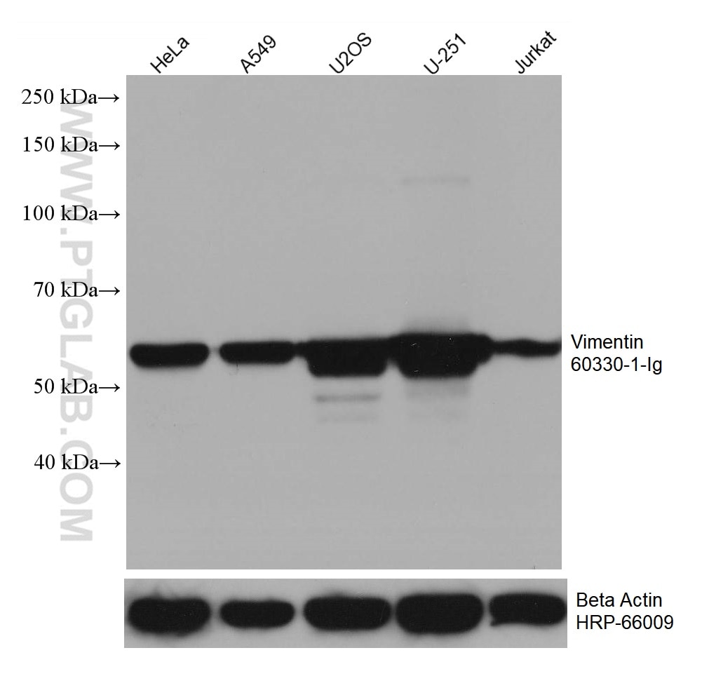 Western Blot (WB) analysis of various lysates using Vimentin Monoclonal antibody (60330-1-Ig)