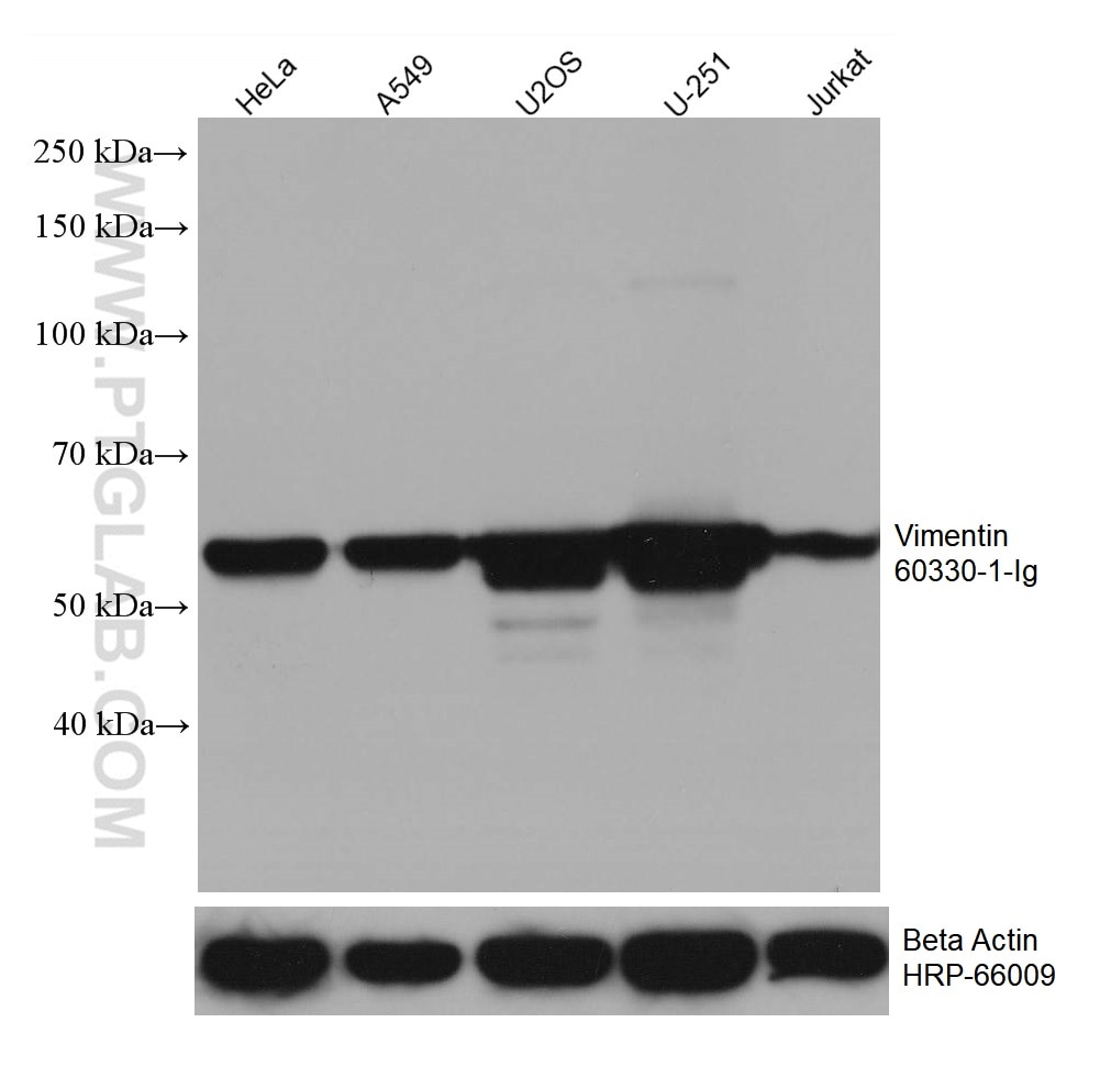 WB analysis using 60330-1-Ig