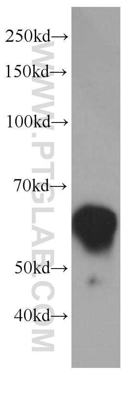 Vimentin Monoclonal antibody