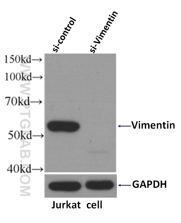 Western Blot (WB) analysis of Jurkat cells using Vimentin Monoclonal antibody (60330-1-Ig)