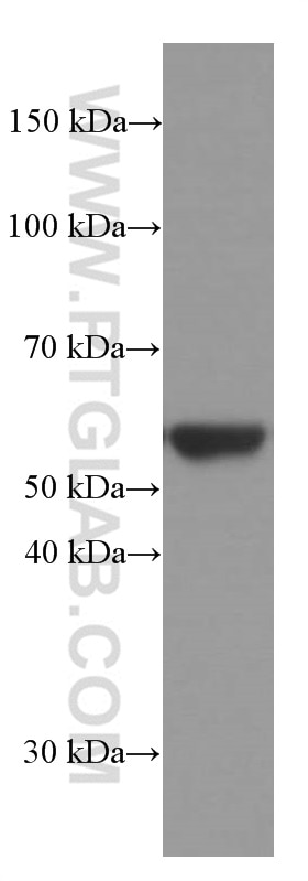 Western Blot (WB) analysis of ROS1728 cells using Vimentin Monoclonal antibody (60330-1-Ig)