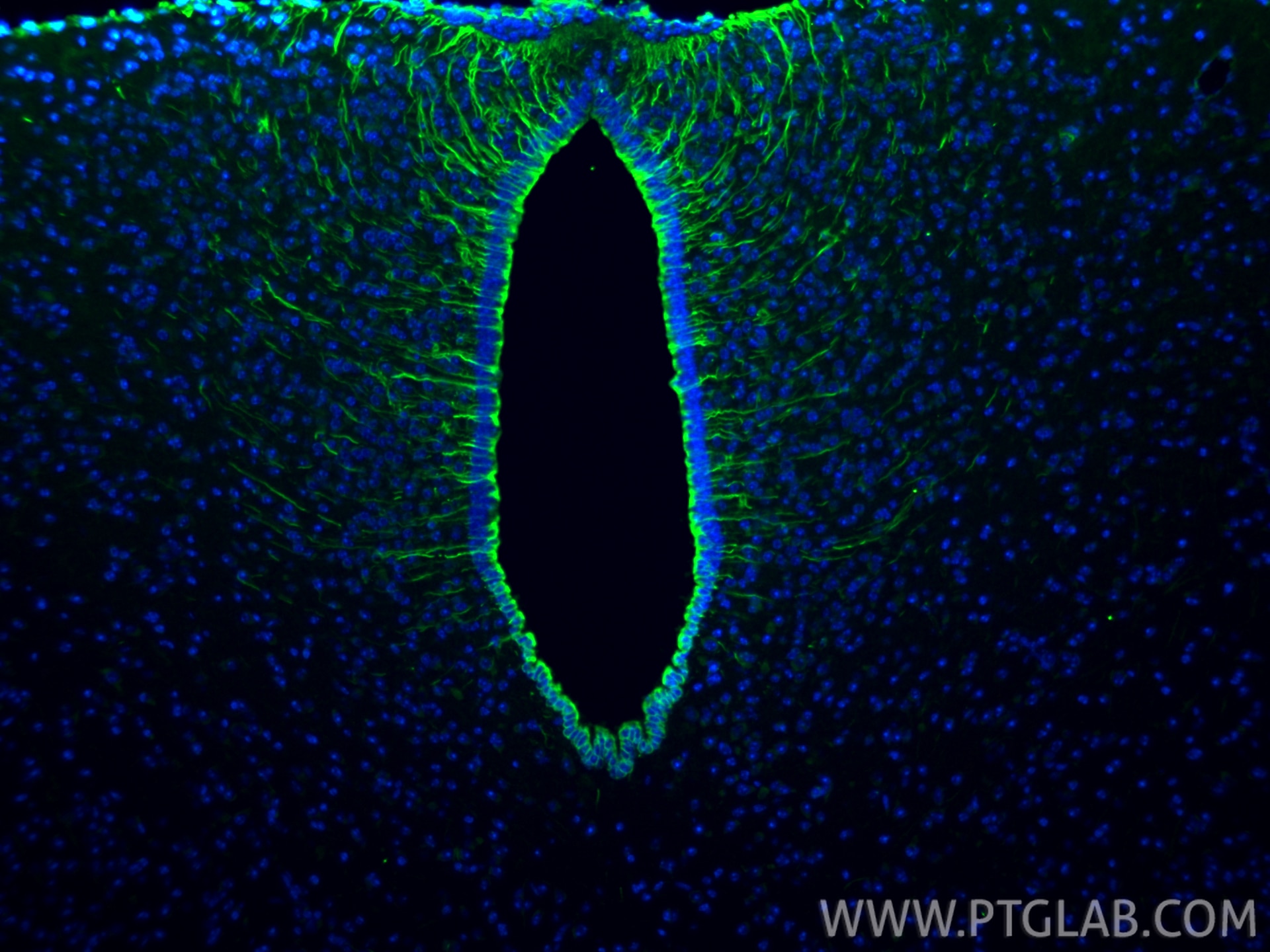 Immunofluorescence (IF) / fluorescent staining of mouse brain tissue using Vimentin Recombinant monoclonal antibody (80232-1-RR)