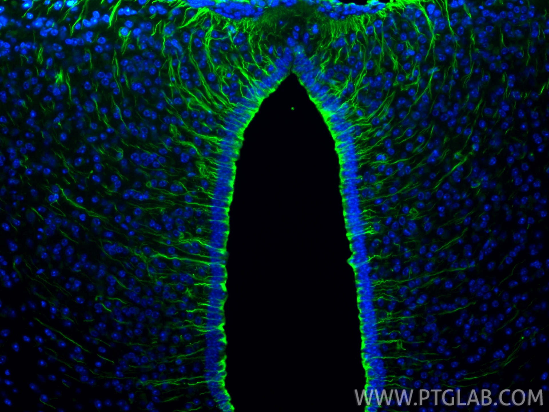Immunofluorescence (IF) / fluorescent staining of mouse brain tissue using Vimentin Recombinant monoclonal antibody (80232-1-RR)