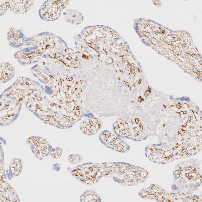 IHC staining of human placenta using 80232-1-RR Immunohistochemistry (IHC) staining of human placenta tissue using Vimentin Recombinant monoclonal antibody (80232-1-RR)