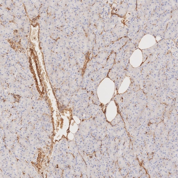 IHC staining of human pancreas using 80232-1-RR Immunohistochemistry (IHC) staining of human pancreas tissue using Vimentin Recombinant monoclonal antibody (80232-1-RR)