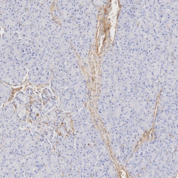 IHC staining of human pancreas using 80232-1-RR Immunohistochemistry (IHC) staining of human pancreas tissue using Vimentin Recombinant monoclonal antibody (80232-1-RR)