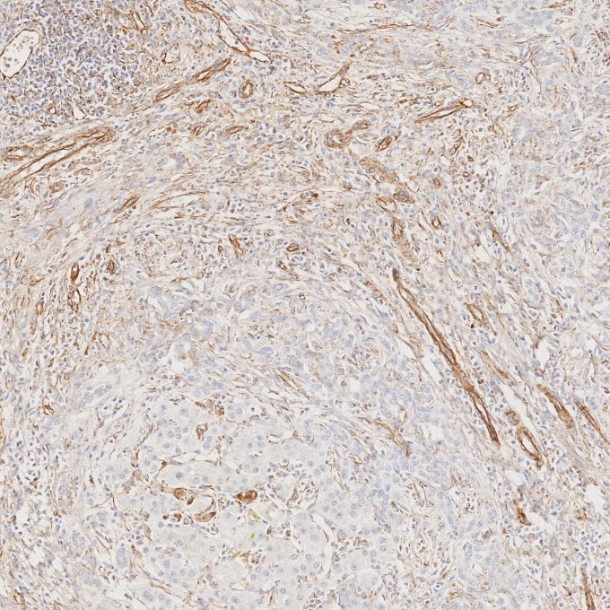 IHC staining of human liver using 80232-1-RR Immunohistochemistry (IHC) staining of human liver tissue using Vimentin Recombinant monoclonal antibody (80232-1-RR)