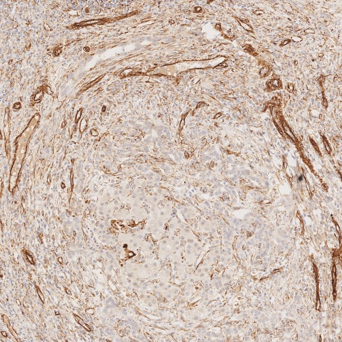 IHC staining of human liver using 80232-1-RR Immunohistochemistry (IHC) staining of human liver tissue using Vimentin Recombinant monoclonal antibody (80232-1-RR)