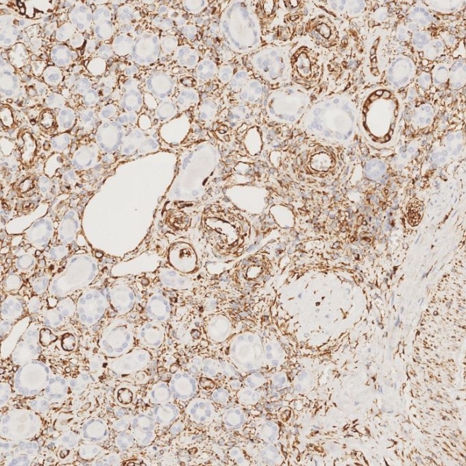 IHC staining of human kidney using 80232-1-RR Immunohistochemistry (IHC) staining of human kidney tissue using Vimentin Recombinant monoclonal antibody (80232-1-RR)