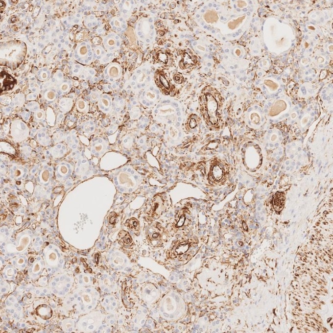 IHC staining of human kidney using 80232-1-RR Immunohistochemistry (IHC) staining of human kidney tissue using Vimentin Recombinant monoclonal antibody (80232-1-RR)