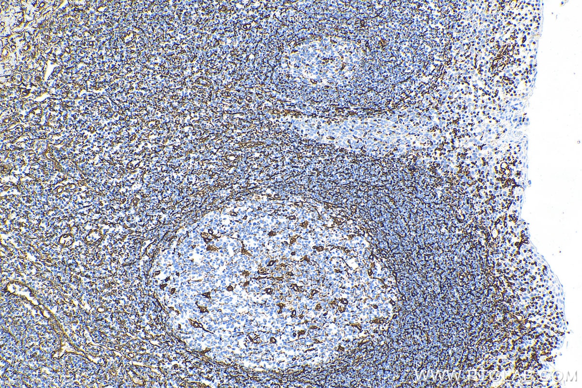 Immunohistochemistry (IHC) staining of human tonsillitis tissue using Biotin-conjugated Vimentin Monoclonal antibody (Biotin-60330)