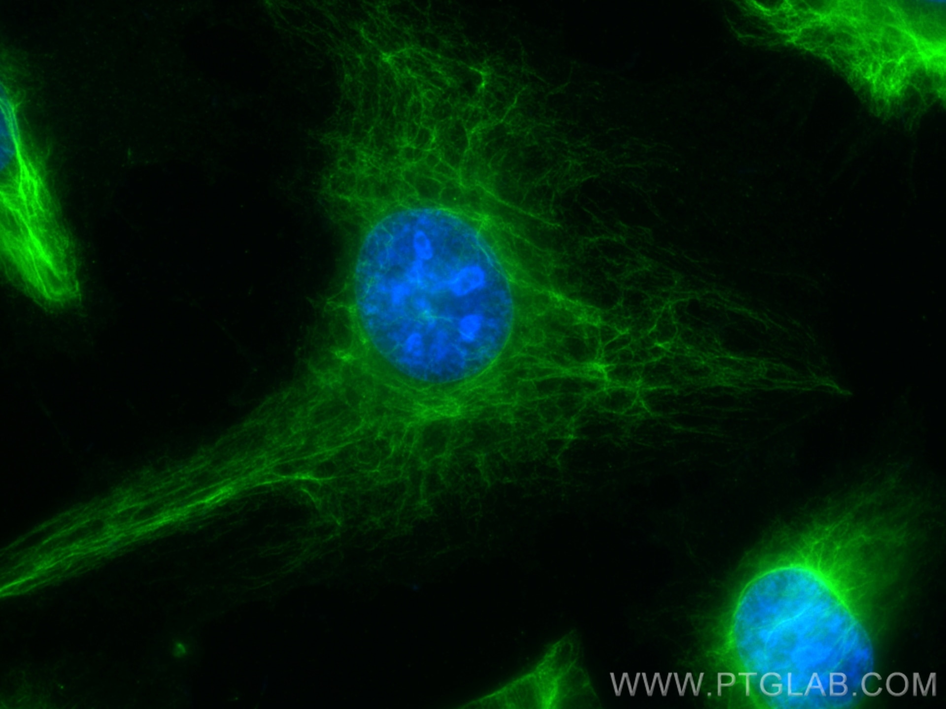 Immunofluorescence (IF) / fluorescent staining of HUVEC cells using CoraLite® Plus 488-conjugated Vimentin Polyclonal  (CL488-10366)