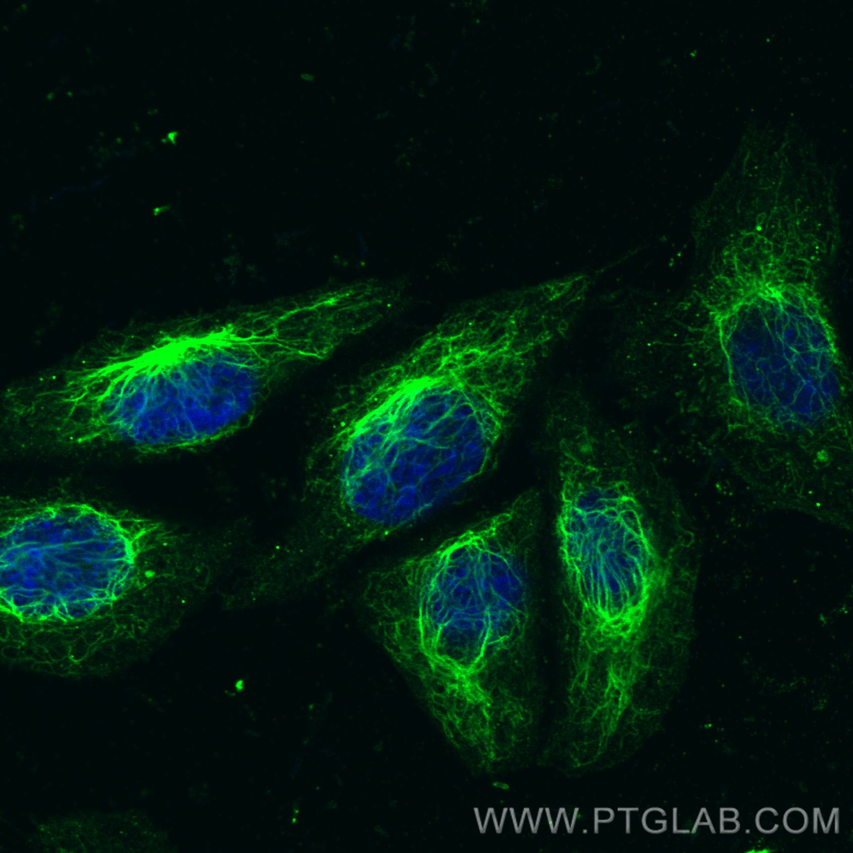 Immunofluorescence (IF) / fluorescent staining of HepG2 cells using CoraLite® Plus 488-conjugated Vimentin Polyclonal  (CL488-10366)