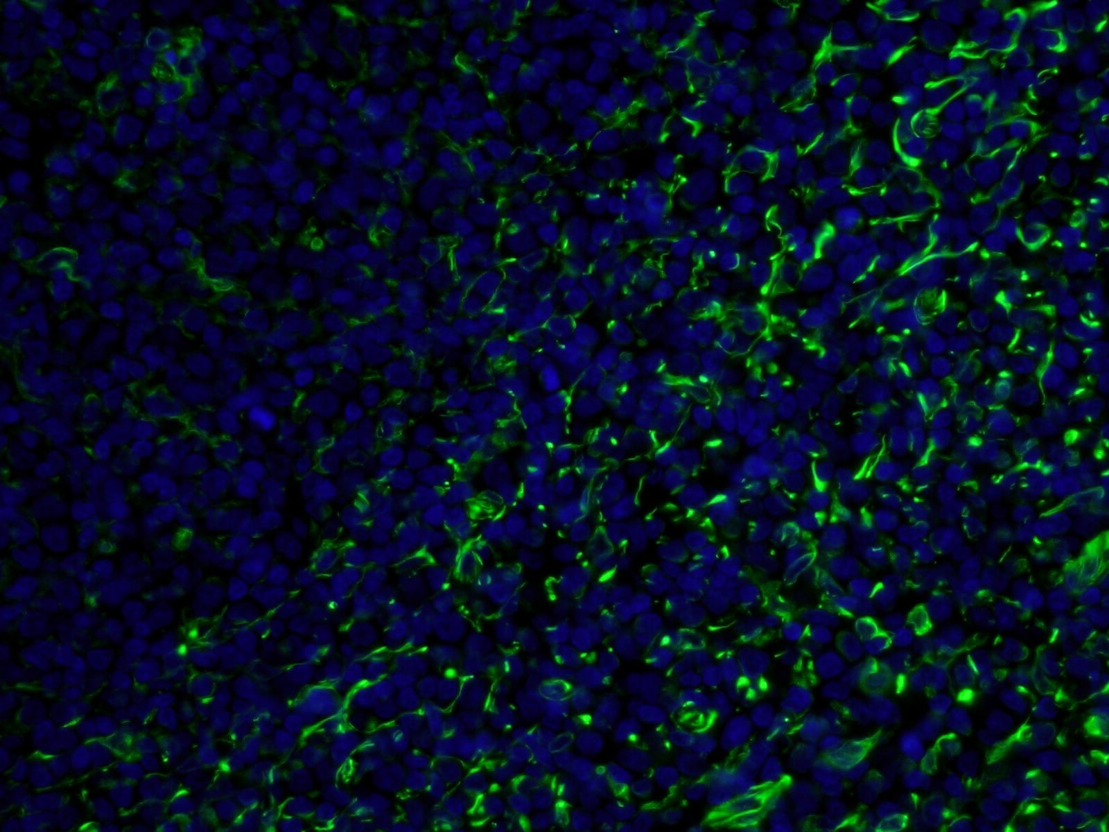 Immunofluorescence (IF) / fluorescent staining of human tonsillitis tissue using CoraLite®488-conjugated Vimentin Monoclonal antibo (CL488-60330)