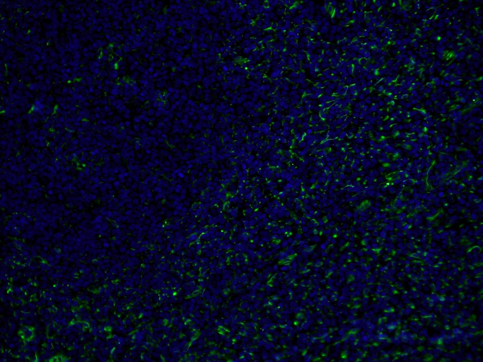 Immunofluorescence (IF) / fluorescent staining of human tonsillitis tissue using CoraLite®488-conjugated Vimentin Monoclonal antibo (CL488-60330)