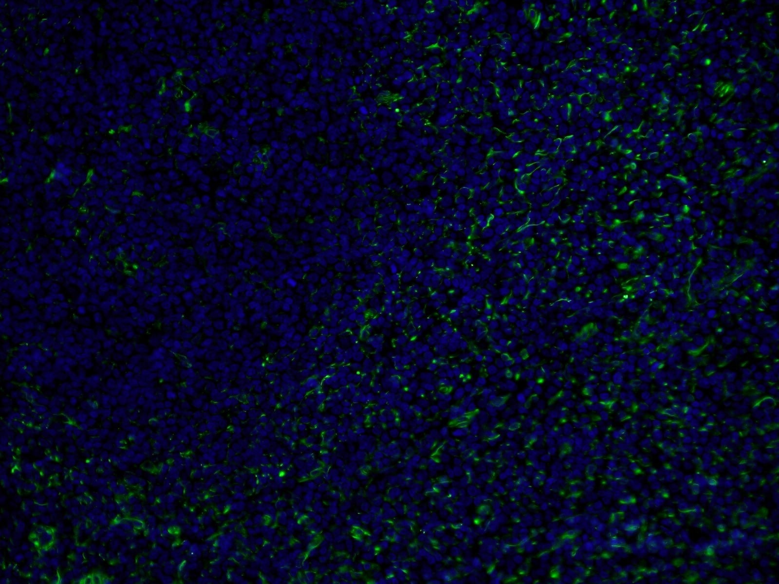 IF Staining of human tonsillitis using CL488-60330