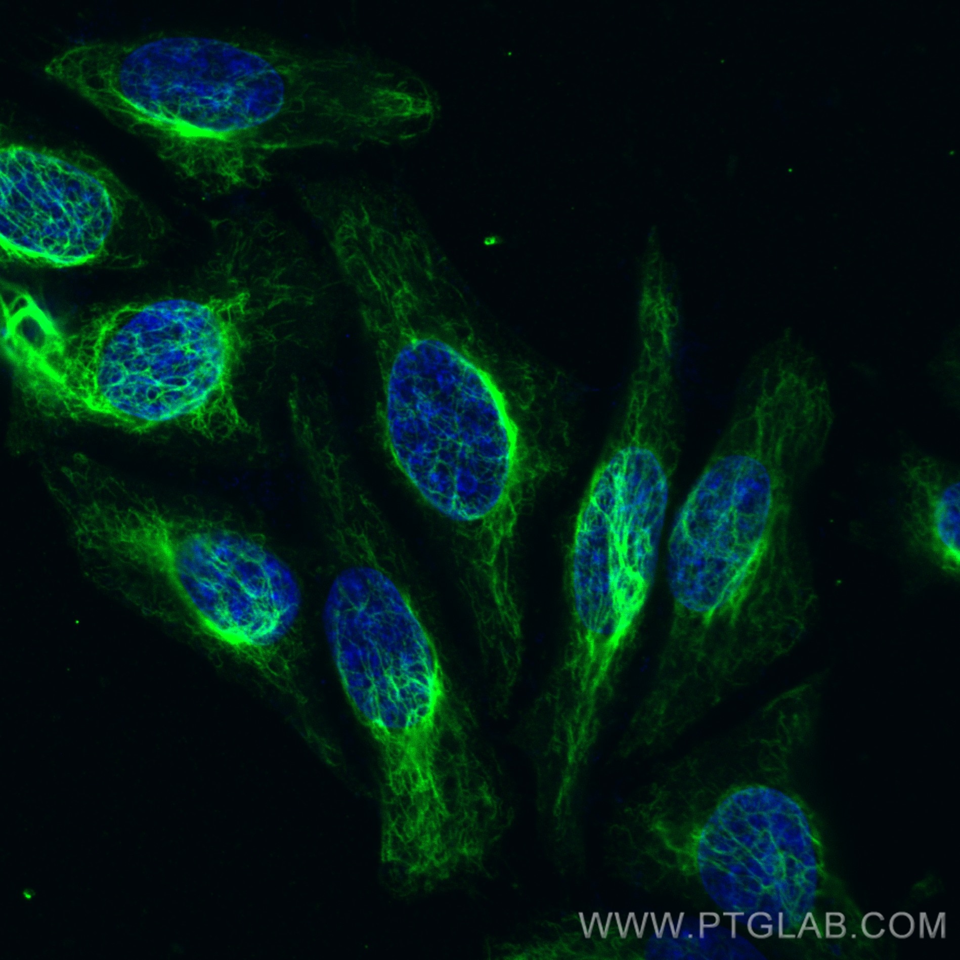 Immunofluorescence (IF) / fluorescent staining of HepG2 cells using CoraLite®488-conjugated Vimentin Monoclonal antibo (CL488-60330)