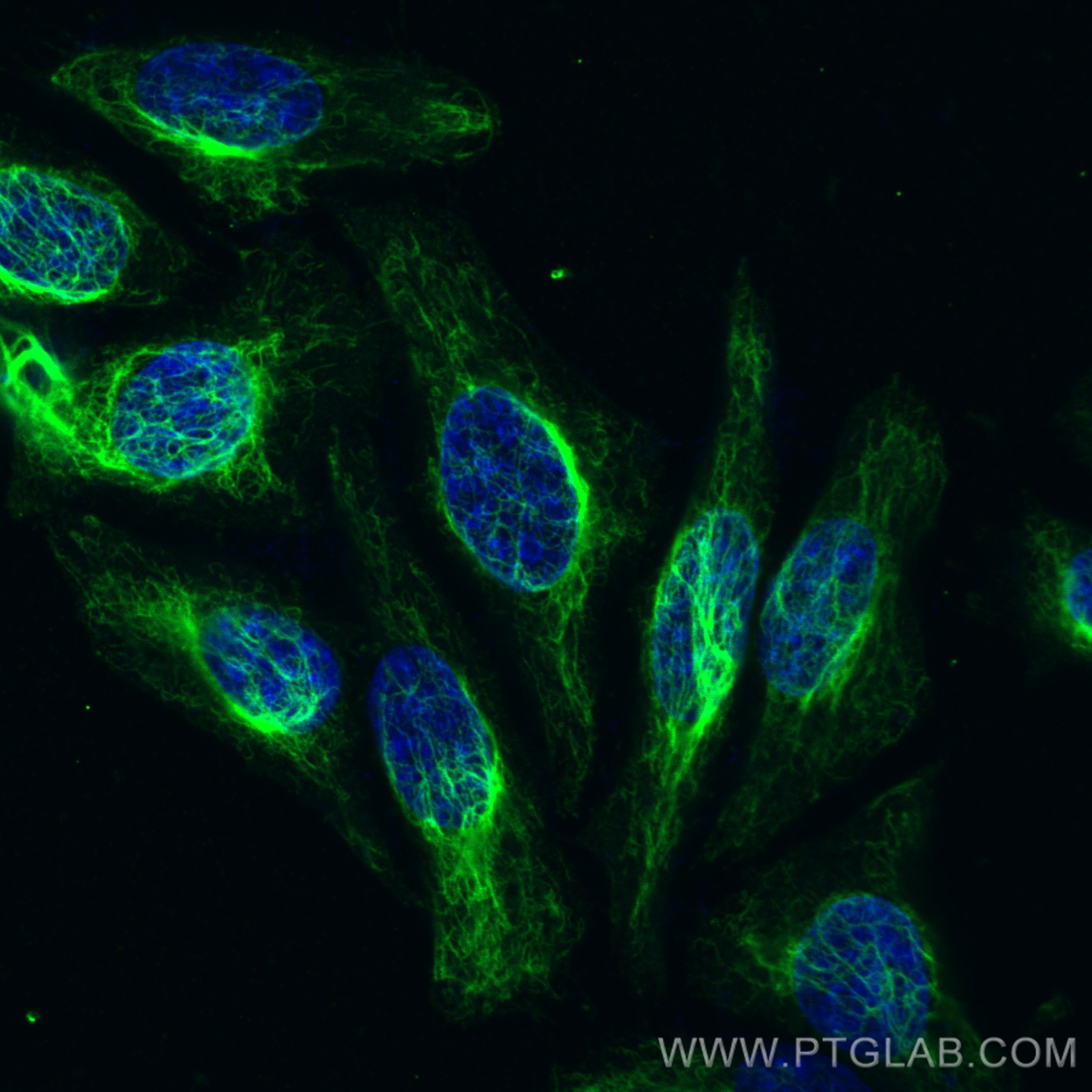 IF Staining of HepG2 using CL488-60330