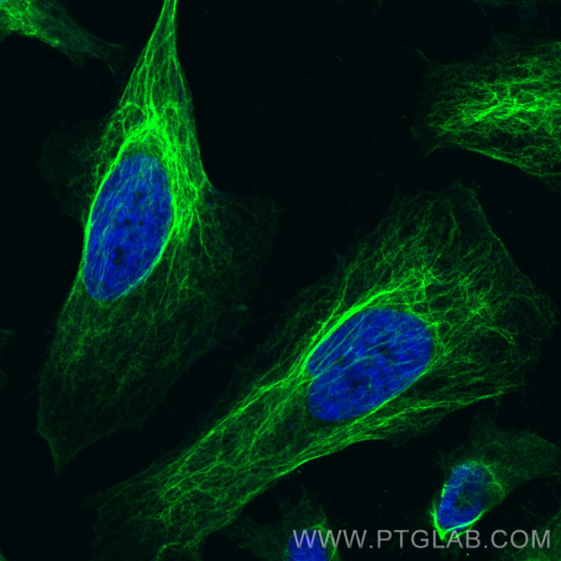 Immunofluorescence (IF) / fluorescent staining of HeLa cells using CoraLite® Plus 488-conjugated Vimentin Recombinant (CL488-80232)