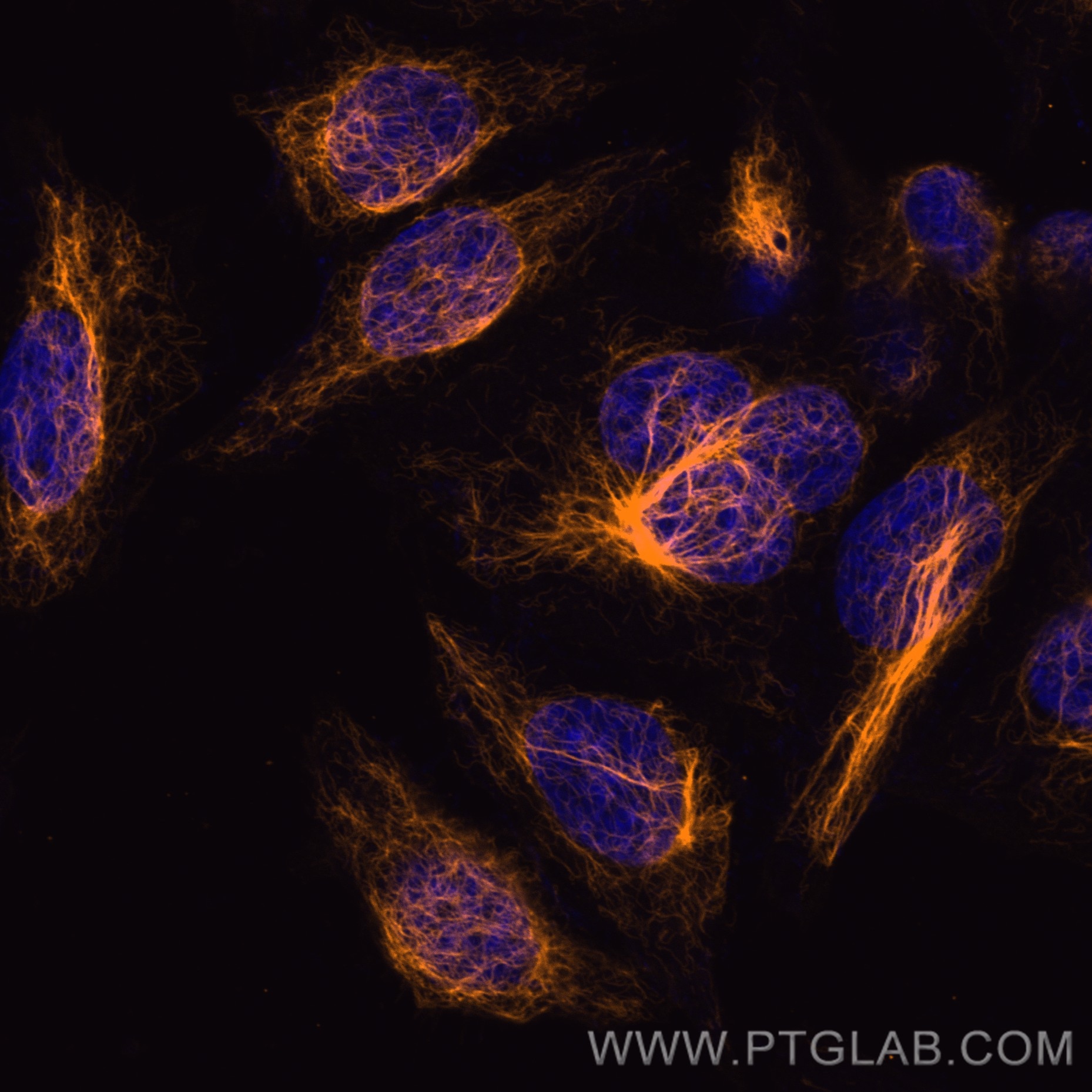 Immunofluorescence (IF) / fluorescent staining of HepG2 cells using CoraLite®555-conjugated Vimentin Monoclonal antibo (CL555-60330)