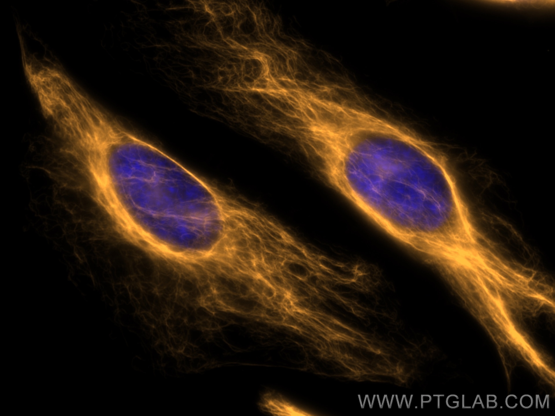 Immunofluorescence (IF) / fluorescent staining of HeLa cells using CoraLite®555-conjugated Vimentin Monoclonal antibo (CL555-60330)