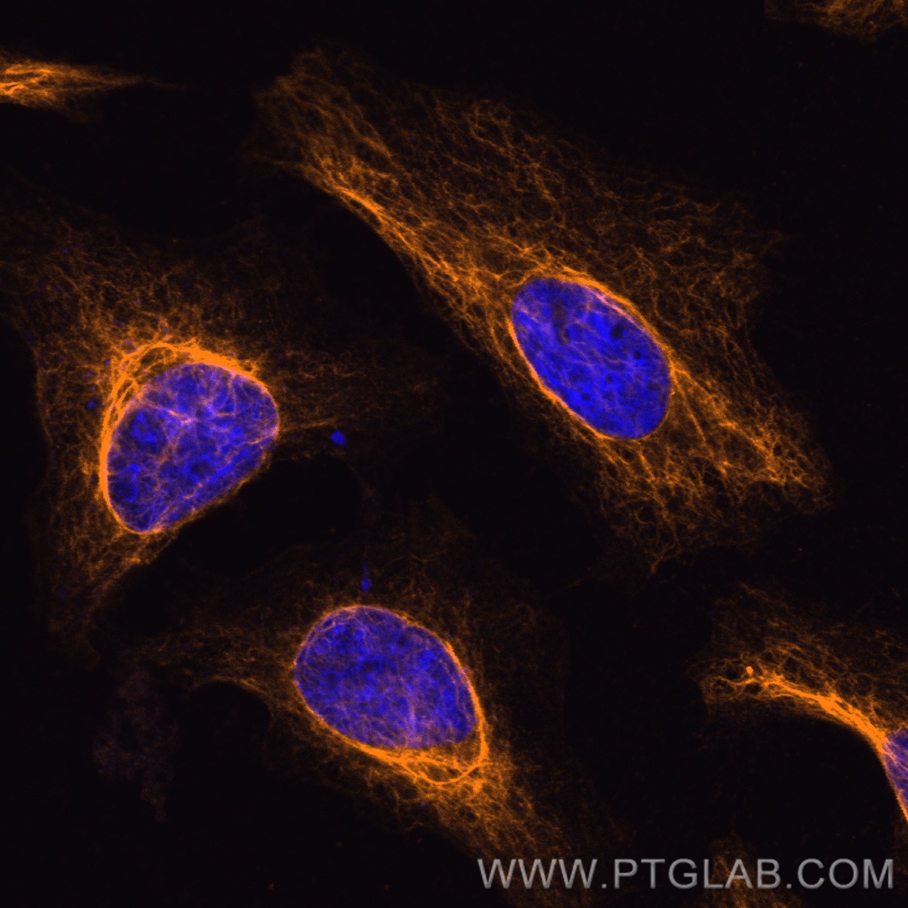 Immunofluorescence (IF) / fluorescent staining of HeLa cells using CoraLite®555-conjugated Vimentin Recombinant antib (CL555-80232)